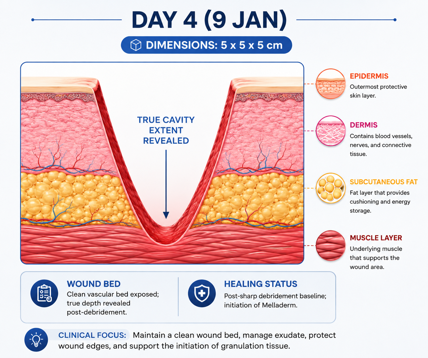Day 4 wound illustration